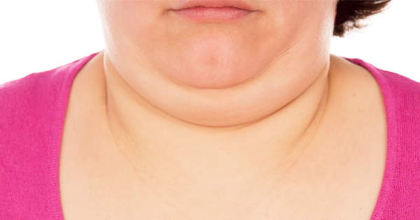 You Can FINALLY Get Rid Of Your Double Chin! The Results Are Amazing!