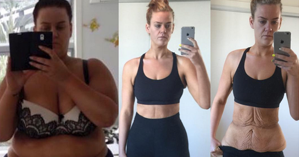 This Woman Lost 190 Pounds And Was Accused Of Faking It. Her Response? INCREDIBLE!