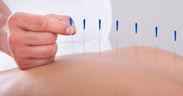 Study: Acupuncture Is The Best Relief For Your Neck Pain