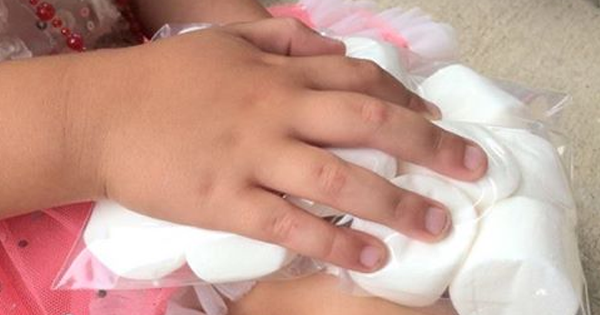 Her Child Gets A Nasty Bruise. Instead Of Ice, She Pulls Out A Bag Of MARSHMALLOWS.