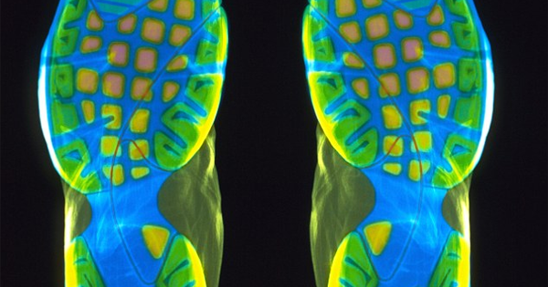 These Athletic Shoes Could Help Detect Arthritis