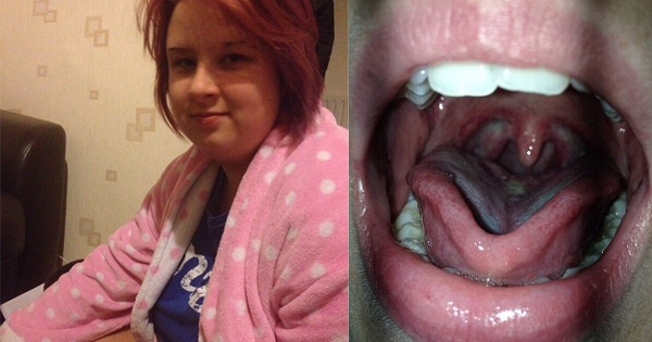 She Goes In To Get Her Tonsils Removed...Then, She WAKES UP During Surgery