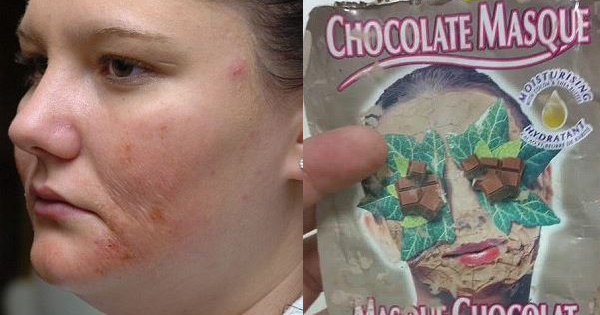 Teen Uses A Cheap CHOCOLATE Face Mask For Blackheads. The BURNING Is Instant...