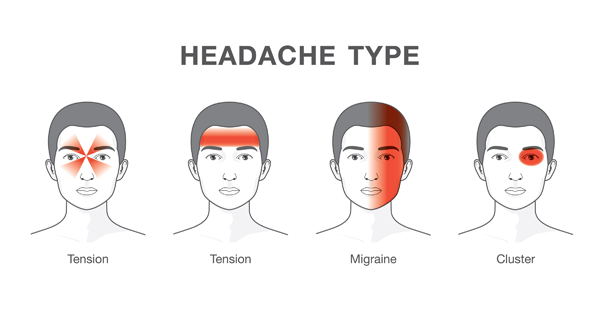 Learn How To Recognize Dangerous Headaches