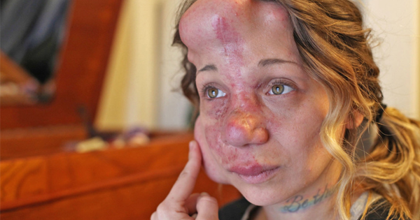 The Shocking Reason Why This Woman Had BALLOONS Inserted Into Her Face
