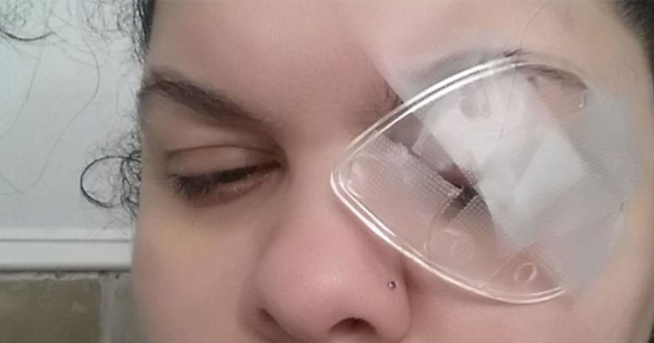 Woman Gets ONE TINY Speck Of Glitter In Her Eye. What Happens Next Is Terrifying