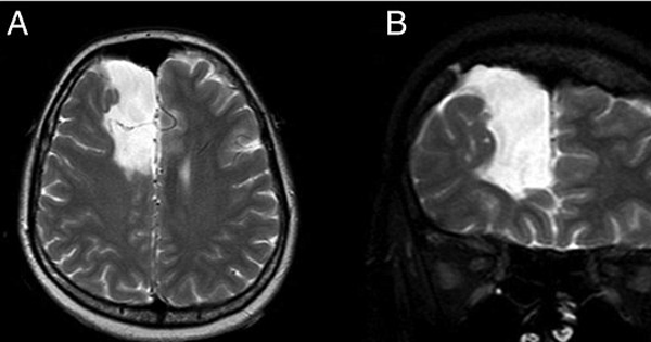 Woman Paranoid Her Husband Is Cheating Gets An MRI. What It Reveals? WHOA...