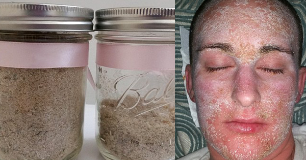 She Filled Up Two Jars With Her DEAD SKIN. The Reason Why? OMG...