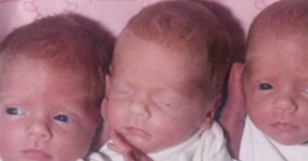 Triplets Were Burned In A House Fire When They Were Babies. 30 Years Later? Here