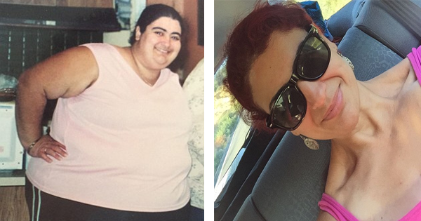 She Gets In A Horrific Accident, But Her WEIGHT Saves Her Life. Here