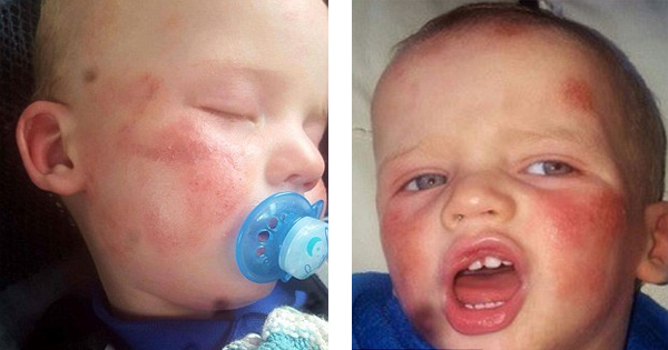 Every Day, Her Son Wakes Up Looking Like THIS. She Finds An Unlikely Solution…