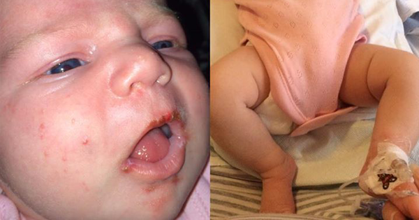 Her Newborn Develops THIS Condition. She Has No Clue Why, Until She Remembers What Happened Earlier…