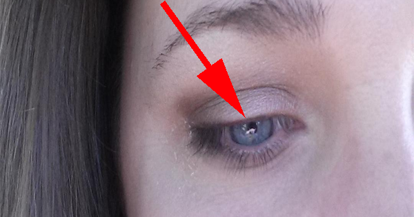 OMG! She Loses Her EYELASHES While Using THIS Beauty Product...