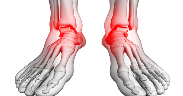You Can Treat Your Foot Pain At HOME