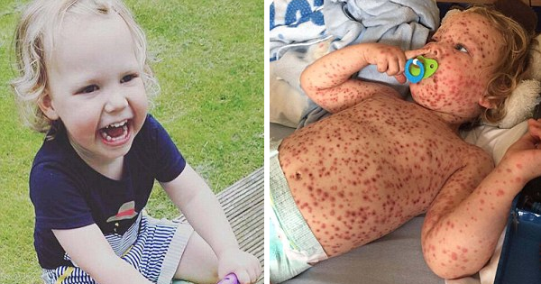 His Doctors REFUSE To See Him For Chicken Pox. Two Days Later, His Mom Finds...