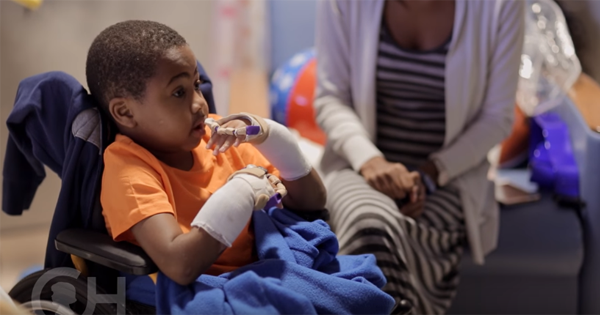 He Lost Both Hands When He Was Two, But Rediscovers His Independence After A Double Hand Transplant
