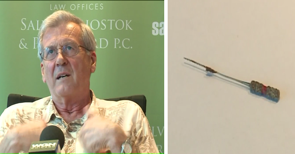 He SWALLOWS This Dental Tool, But His Dentist DOESN