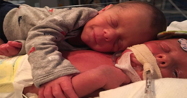 This Newborn Passed Away Days After His Twin Brother Held Him In A Sweet Embrace