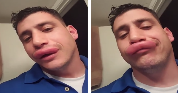 Watch The Hilarious Way This Man Handles Getting Two Wasp Stings On His Lip