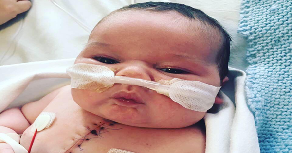 He Is Born With Only Half His Heart And Has To Undergo Open Heart Surgery At Four Days Old