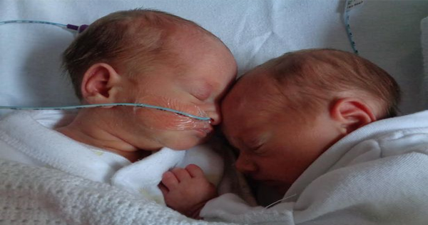 While In The Womb, Twins Run The Risk Of Suffering From A Cardiac Arrest. Doctors Operate On Them, But Can