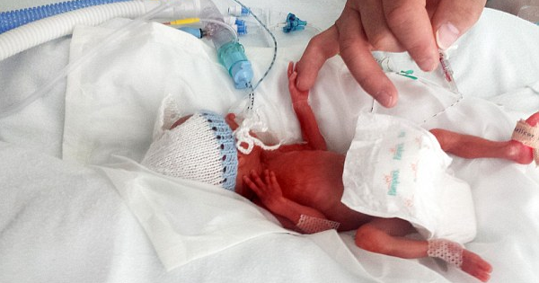 Her Identical Triplets Are Born After Only 23 Weeks And Weigh Less Than 3 Pounds, Total.