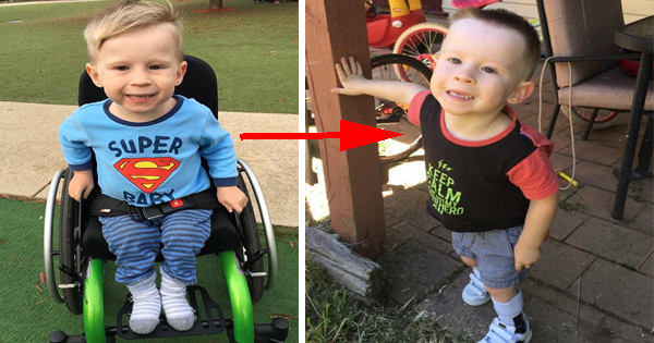 A Boy Born Without The Lower Half Of His Spine And Calf Muscles Has Just Learned To Walk