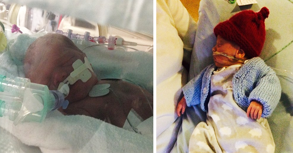 This Mother Goes Into Labor Twice To Give Birth To Her Twins Six Weeks Apart.
