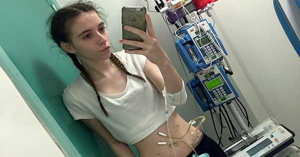 Doctors Were Unable To Diagnose Her Nausea and Stomach Pain For Two Years. Now They Say She May Never Eat Again.
