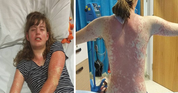 She Suffers From A Rash And Vomits For 10 Weeks, But Doctors Still Refuse To See Her.