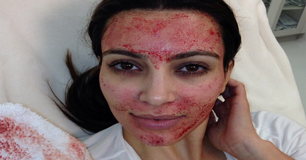 She Takes Her Own Blood And Spreads It All Over Her Face. Now Look At What It Does To Her Body