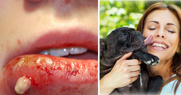 Doctors Are Now Warning: Do Not Let Your Dogs Lick You