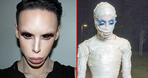 After Spending $50,000 On Plastic Surgery, He Now Wants To Remove One Last Thing To Complete His Transformation Into An Alien.