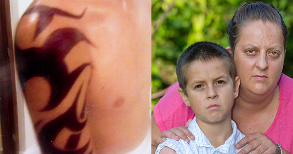 Mom Warns Other Parents About The Dangers Of Henna Tattoo After Her Son
