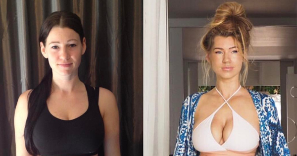 She Shows Her Body Transformation After 5 Years. But What She Struggles With The Most Is What