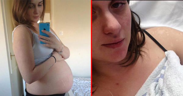 She Suffers From A Stroke While Giving Birth To Her Kid. When Doctors Find Out What