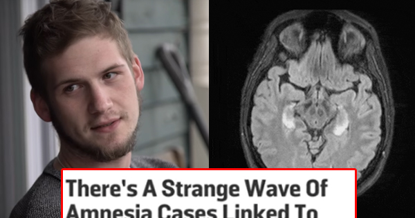 After Suffering From A Drug Overdose, This Man Loses All Of His Memory. Although Doctors Don