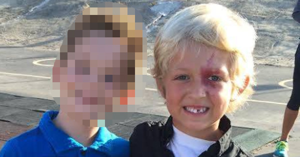 Boy With Unique Birthmark Gets Sick Of Everyone Asking Him Questions. Then A Boy On The Playground Says Something That Leaves Him Speechless.