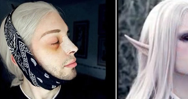 Man Spends $5,000 A Month To Transform Himself Into A White Elf.