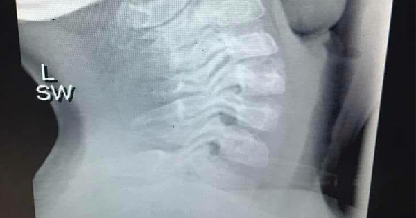 What Doctors Found In This Little Boy
