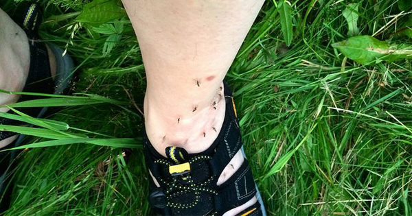 Insect Bites & Stings: 5 Common Bugs To Watch Out For